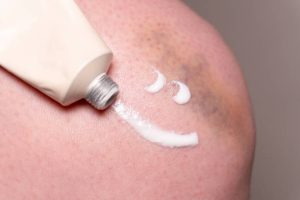 Healora Intertrigo Relief Cream Review: Can It Help Skin Fold Irritation on your skin?