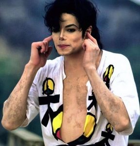 Did Michael Jackson Bleach His Skin Color or Have Vitiligo? What We Know ?